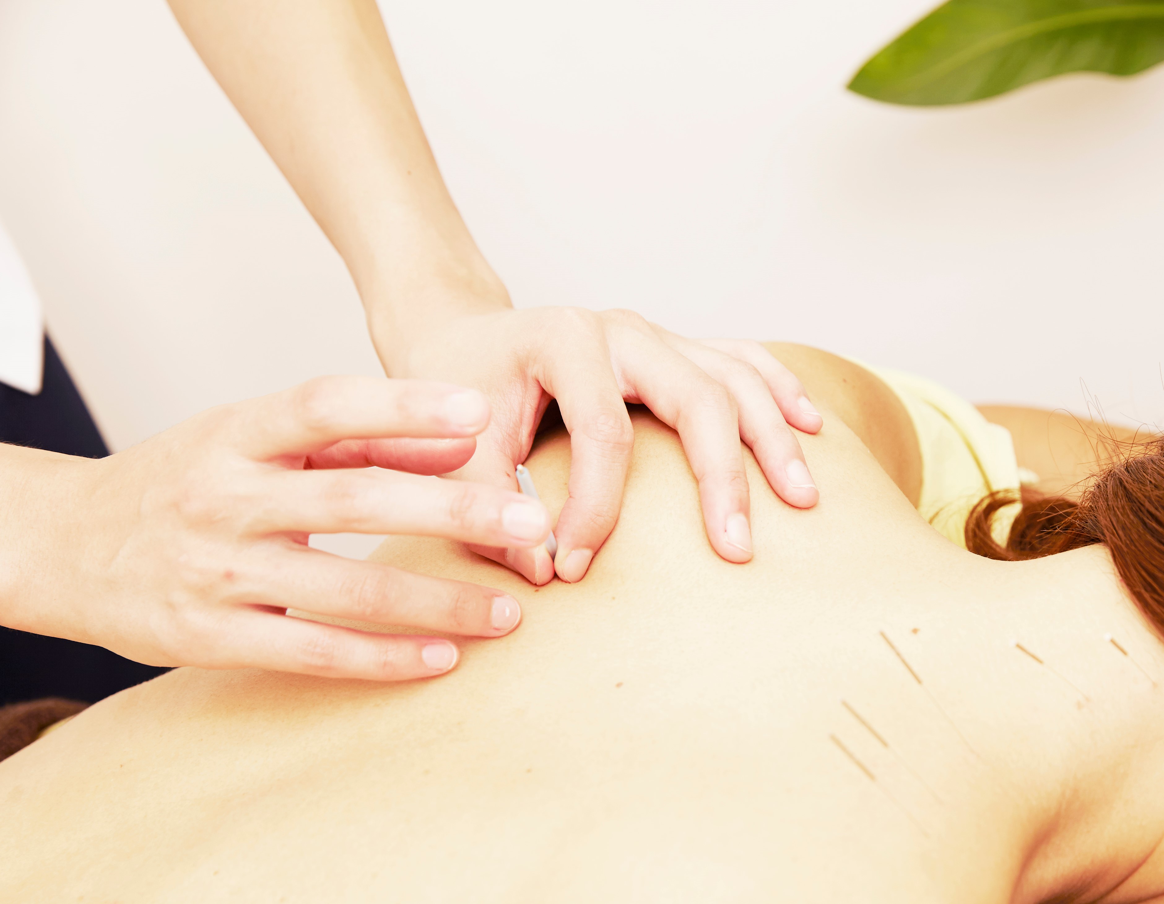 鍼灸で期待できる効果