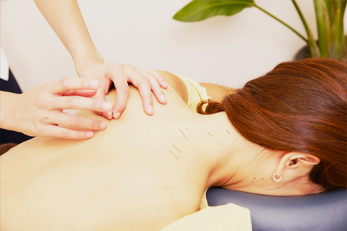 慢性的な痛みや筋肉のコリにー鍼治療